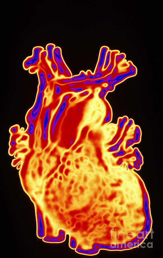 Computer Enhanced Heart Photograph by Scott Camazine