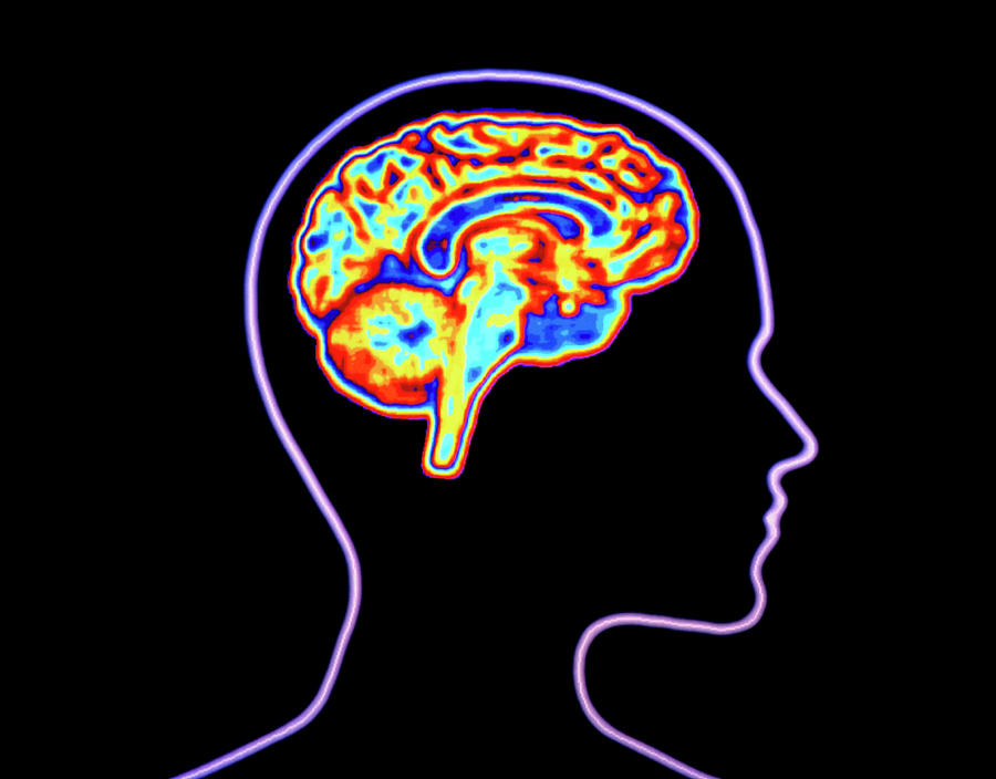 Computer Graphic Of Brain With Silhouette Of Head Photograph By Alfred Pasieka Science Photo
