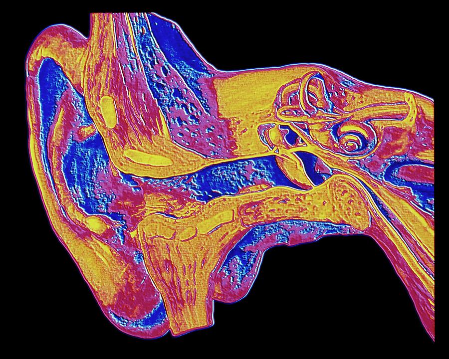 Computer Graphic Of The Anatomy Of The Human Ear Photograph by Alfred Pasieka/science Photo Library