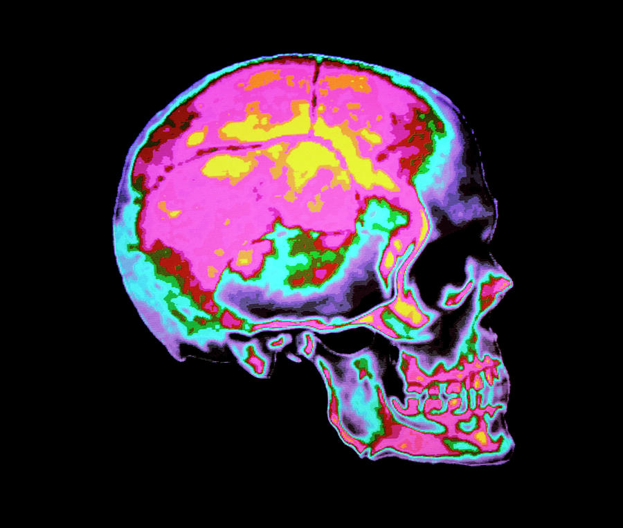 Computer Graphics Coloured Human Skull Photograph by Alfred Pasieka/science Photo Library