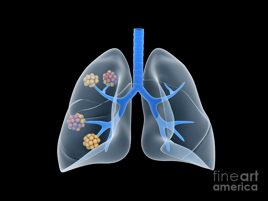 Conceptual Image Of Human Lungs Digital Art