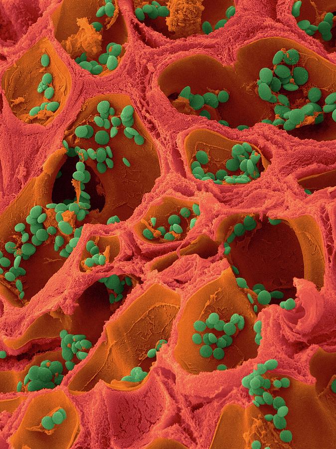 Coralline Red Alga Photograph by Dennis Kunkel Microscopy/science Photo Library