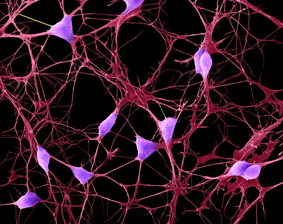 Cortical Neurons Photograph by Dennis Kunkel Microscopy/science Photo Library