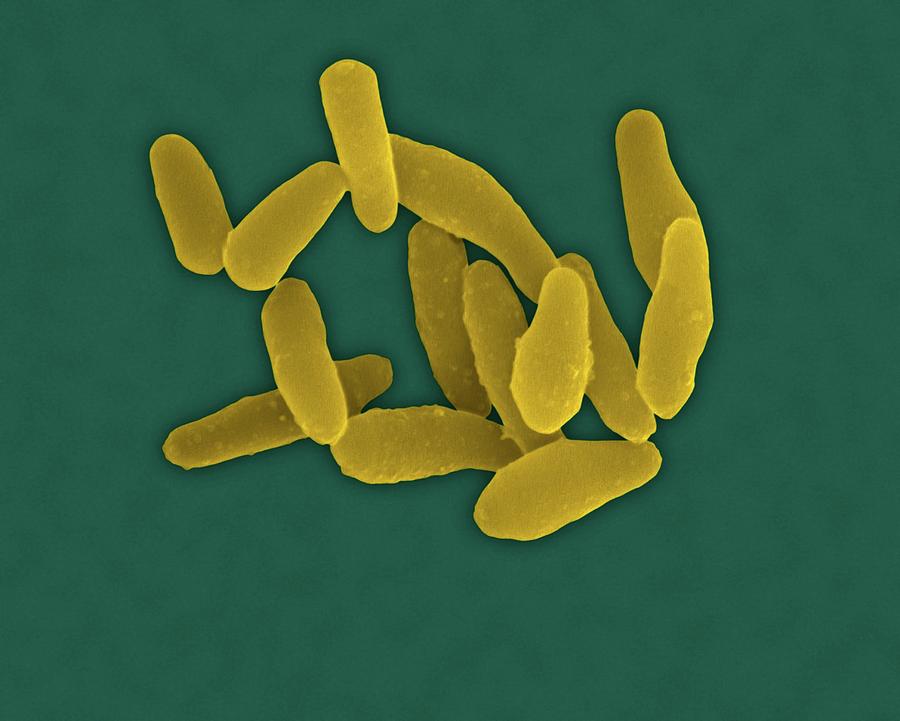 Corynebacterium Diphtheriae Photograph by Dennis Kunkel Microscopy ...