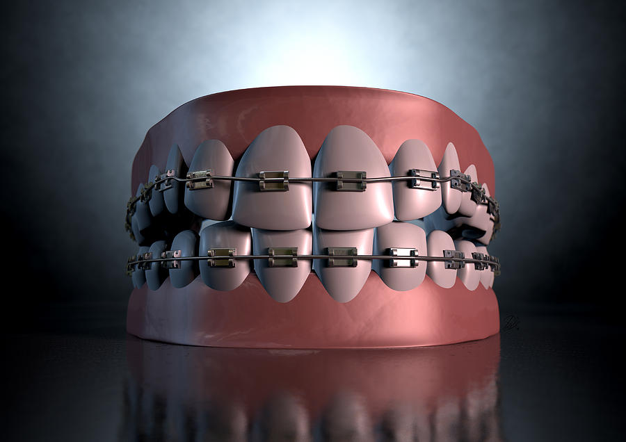 Teeth Digital Art - Creepy Teeth With Braces by Allan Swart