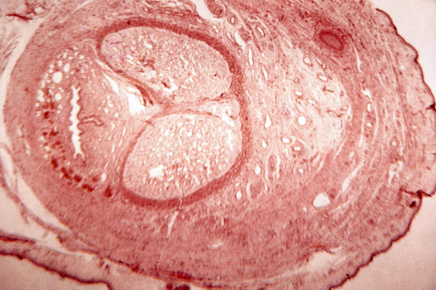 Cross Section Of Fetal Penis, Lm Photograph by Biology Media