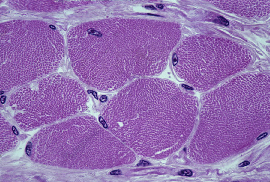 Cross-section Of Skeletal Muscle Fibers. Peripheral Nuclei, Connective Tissue And Myofibers. 800x Photograph by Ed Reschke