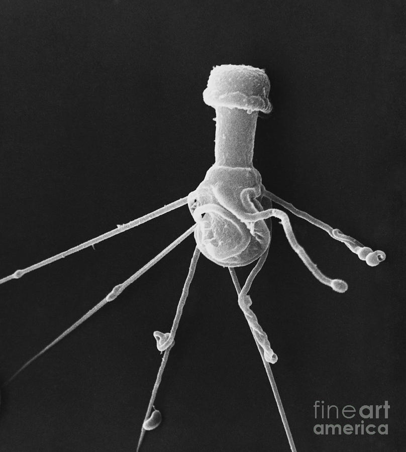 Crustacean Sperm Sem Photograph by David M. Phillips / The Population Council