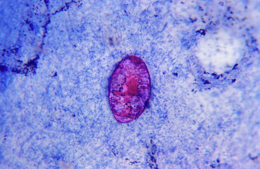 Cryptosporidium In Aids Photograph by Dr M.a. Ansary/science Photo ...