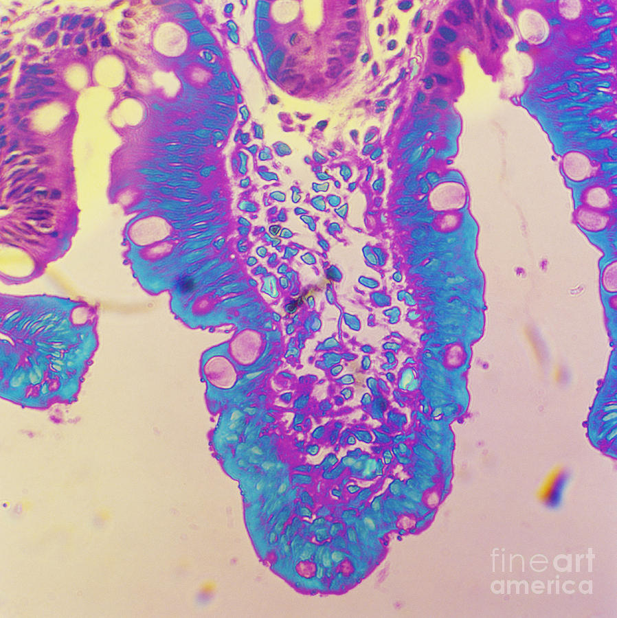 Histology Photograph - Cryptosporidium In Intestine Of Baby by Dr. Cecil H. Fox