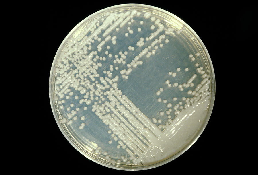 Cultured Cryptococcus Fungus Photograph by Cnri/science Photo Library