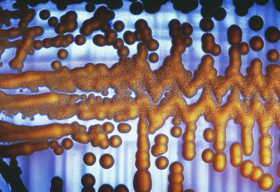 Cultured E. Coli Bacteria Photograph by Cnri/science Photo Library