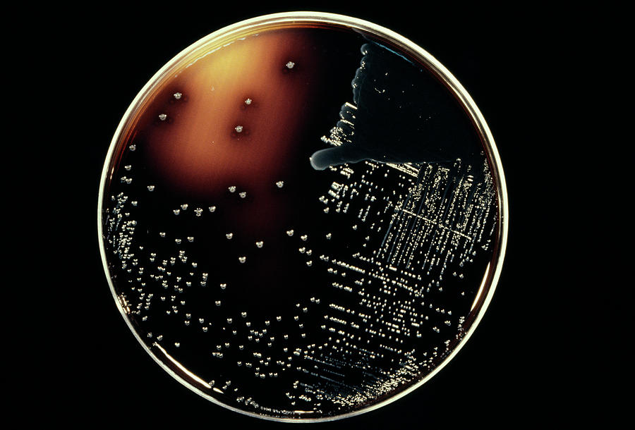 Cultured Enterococcus Bacteria Photograph by Cnri/science Photo Library ...