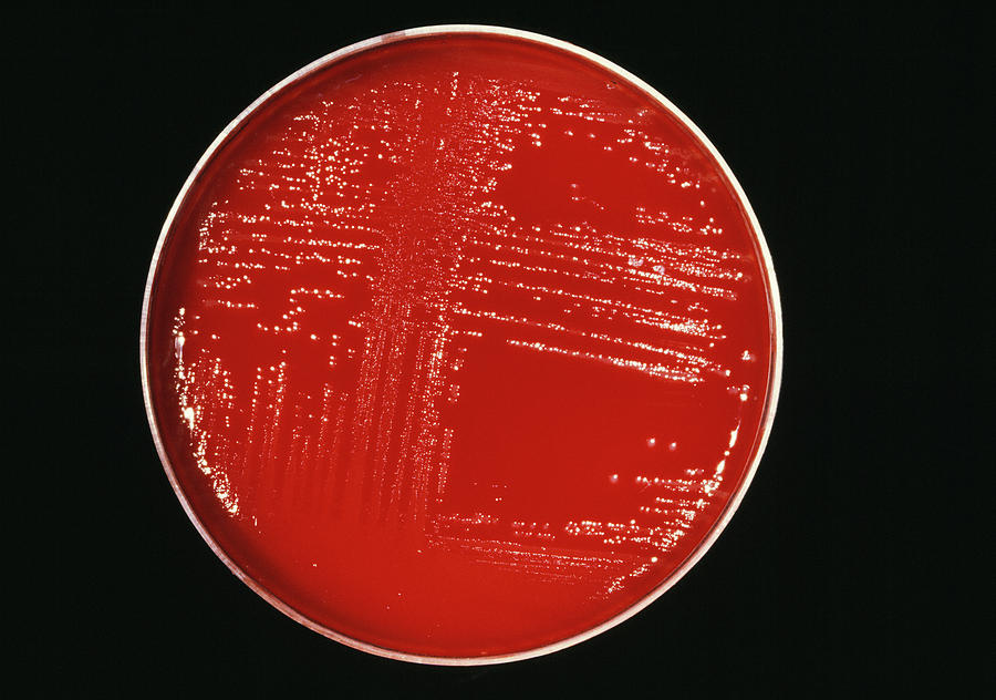 Medicine Photograph - Cultured Listeria Bacteria by Cnri/science Photo Library