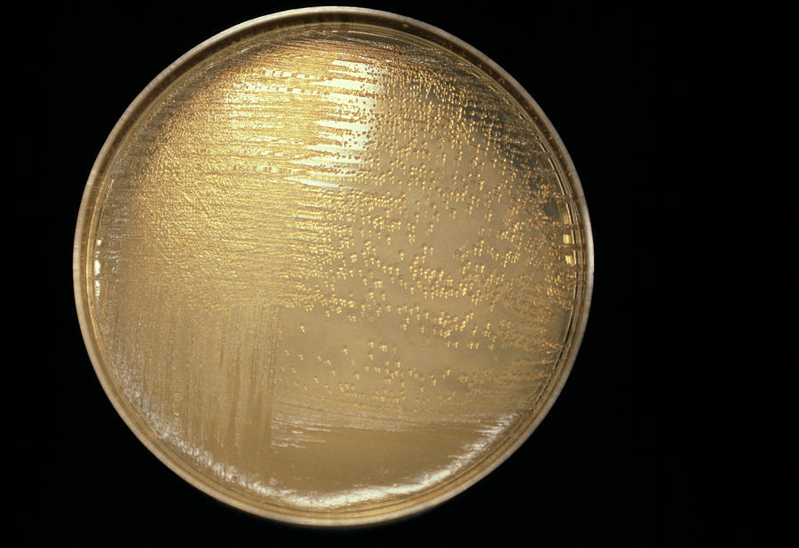 Cultured Plague Bacteria Photograph by Cnri/science Photo Library | Pixels