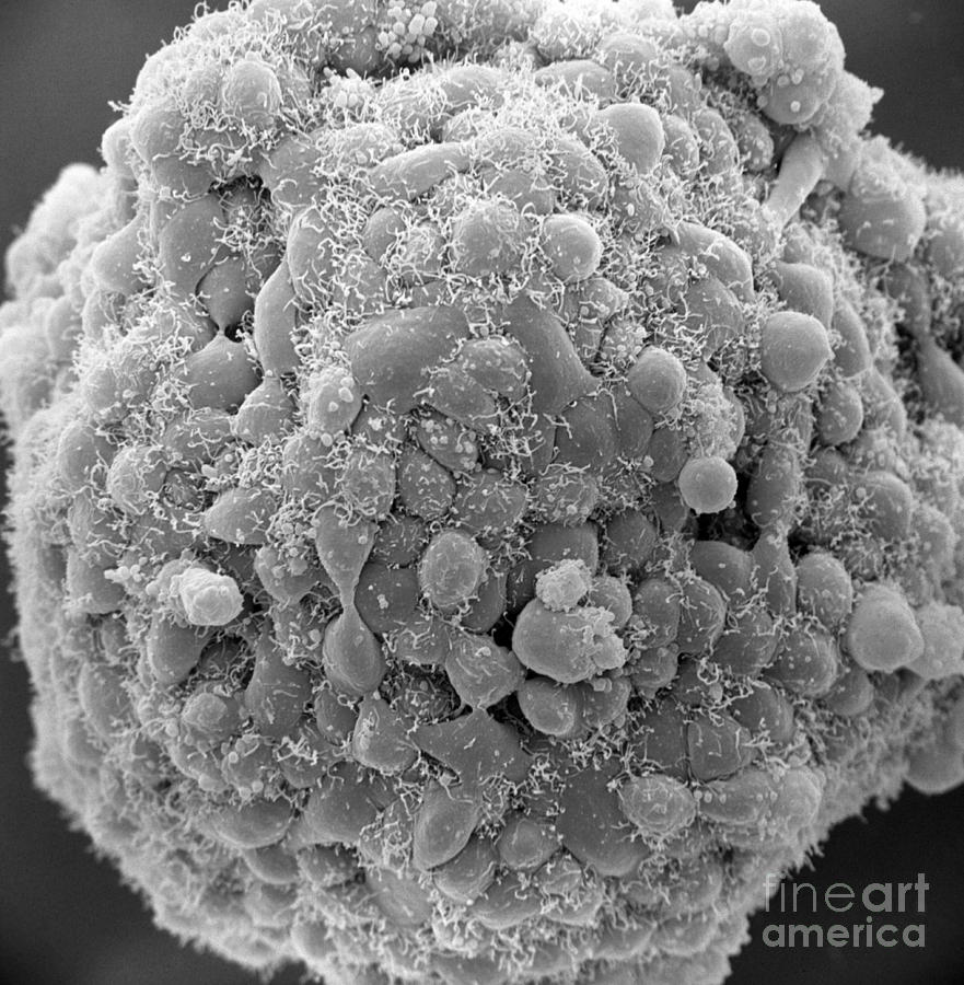 Cumulus Cells Photograph by David M. Phillips