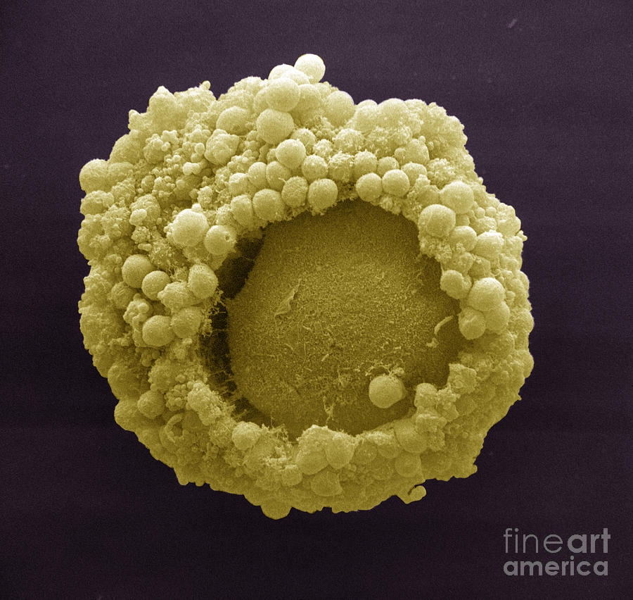 Cumulus Oophorus Cells Photograph by David M. Phillips