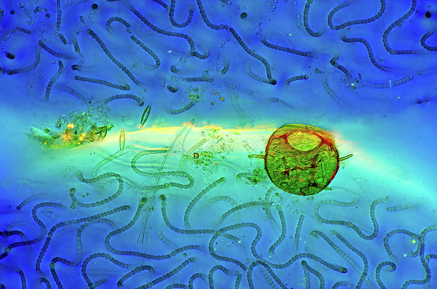 Cyanobacteria And Amoeba Photograph by Marek Mis