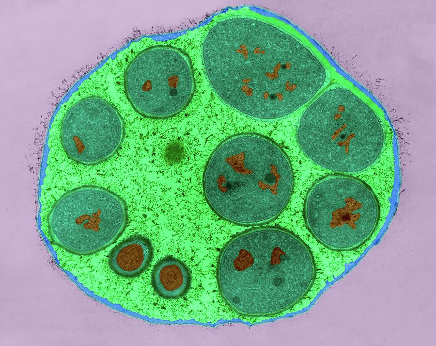 Cyanobacteria Endospores (dermocarpa Sp.) Photograph by Dennis Kunkel Microscopy/science Photo Library