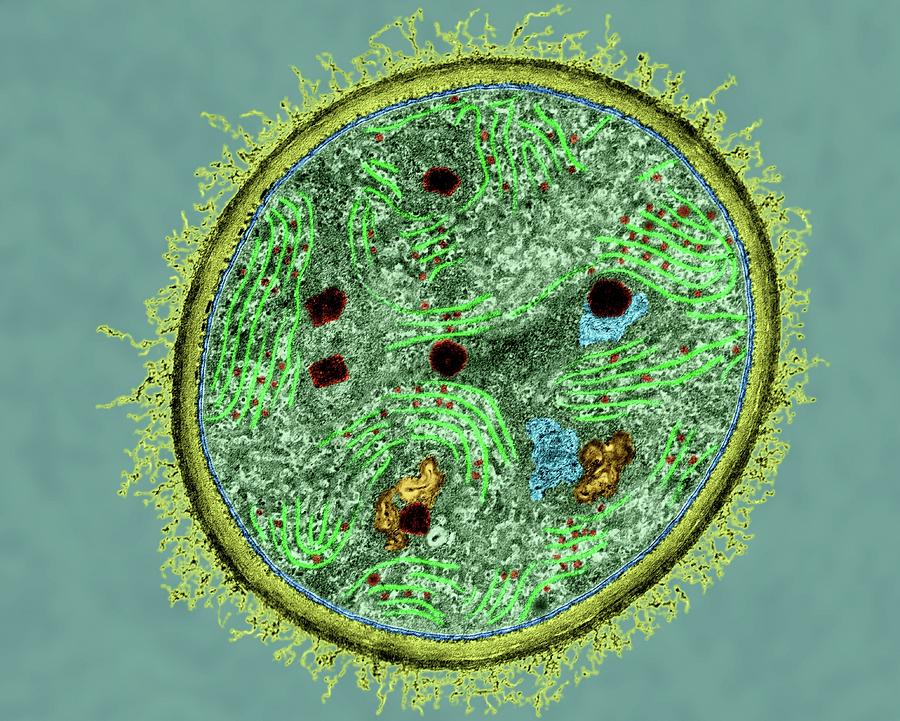 Cyanobacterium (dermocarpa Sp.) Photograph by Dennis Kunkel Microscopy/science Photo Library