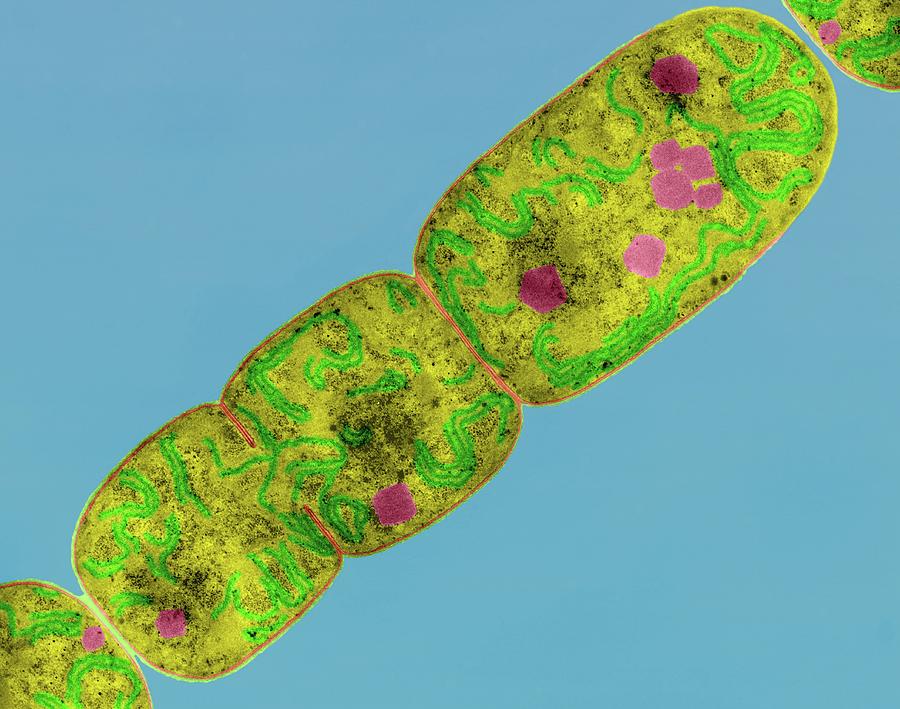  Cyanobacteria  Nostoc Under  Microscope  Micropedia
