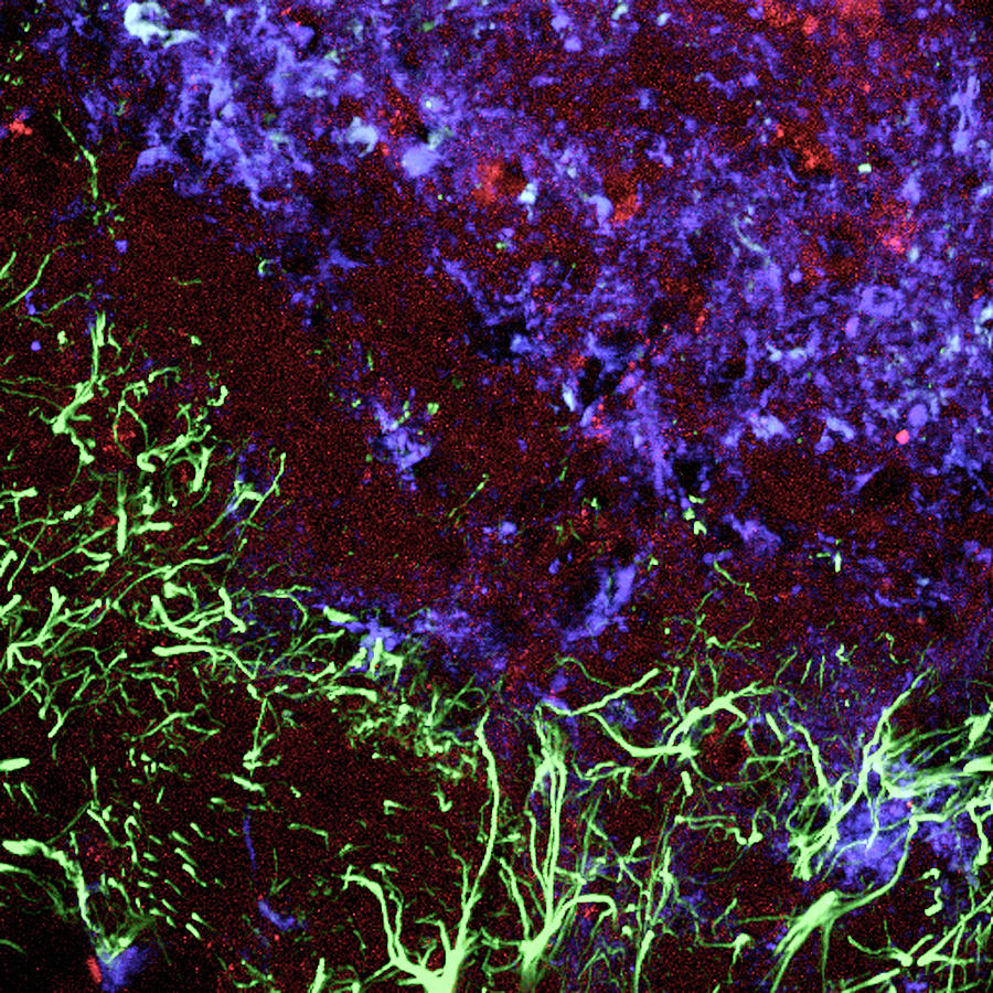 Damaged Brain Tissue Photograph by C.j.guerin, Phd, Mrc Toxicology Unit/ Science Photo Library