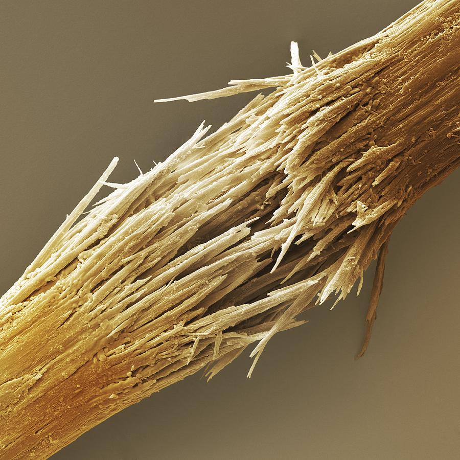 Damaged human hair shaft SEM Photograph by Science Photo Library - Pixels