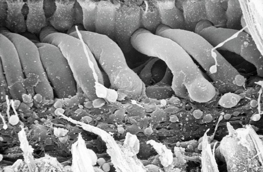 Damaged Inner Ear Hair Cells Photograph by Dr Goran Bredberg/science