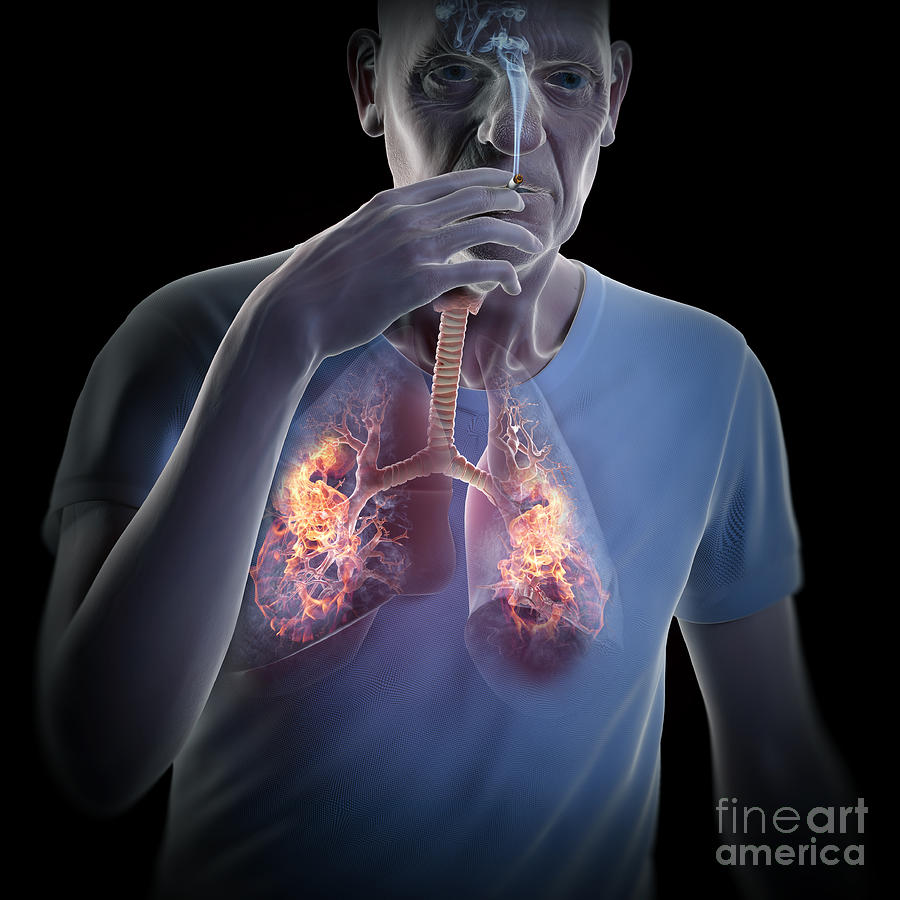 Dangers Of Smoking Photograph by Science Picture Co