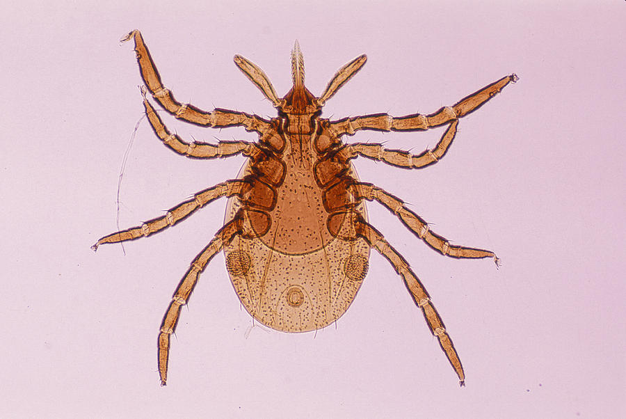 Deer Tick Nymph. Ixodes Dammini. Vector Of Lyme Disease. Head Contains Formidable Piercing Organ (hypostome). 10x Photograph by Ed Reschke
