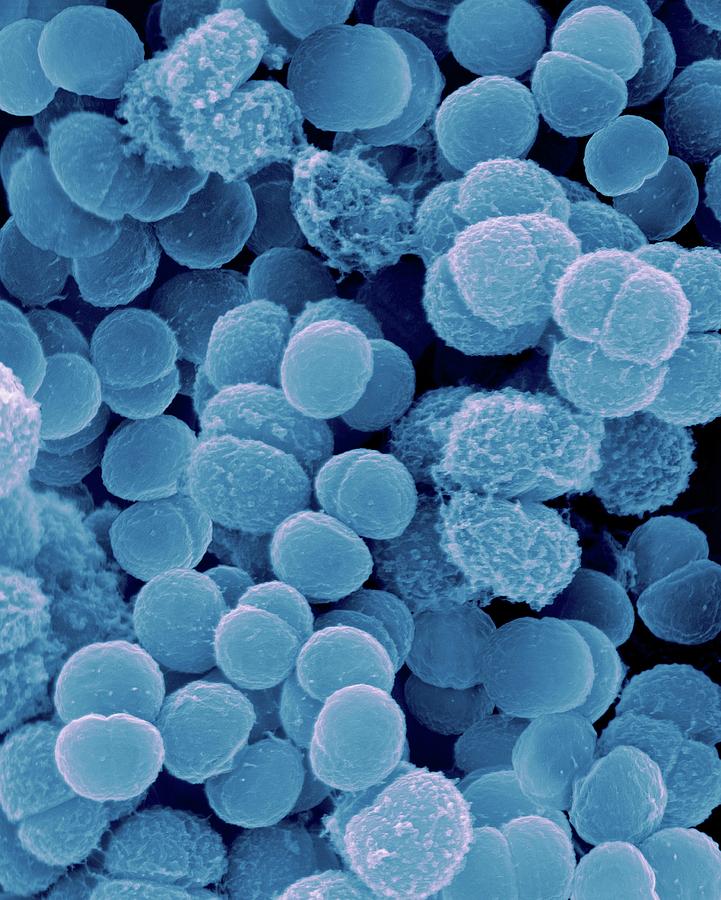 Deinococcus Sp. Coccoid Prokaryote Photograph by Dennis Kunkel Microscopy/science Photo Library