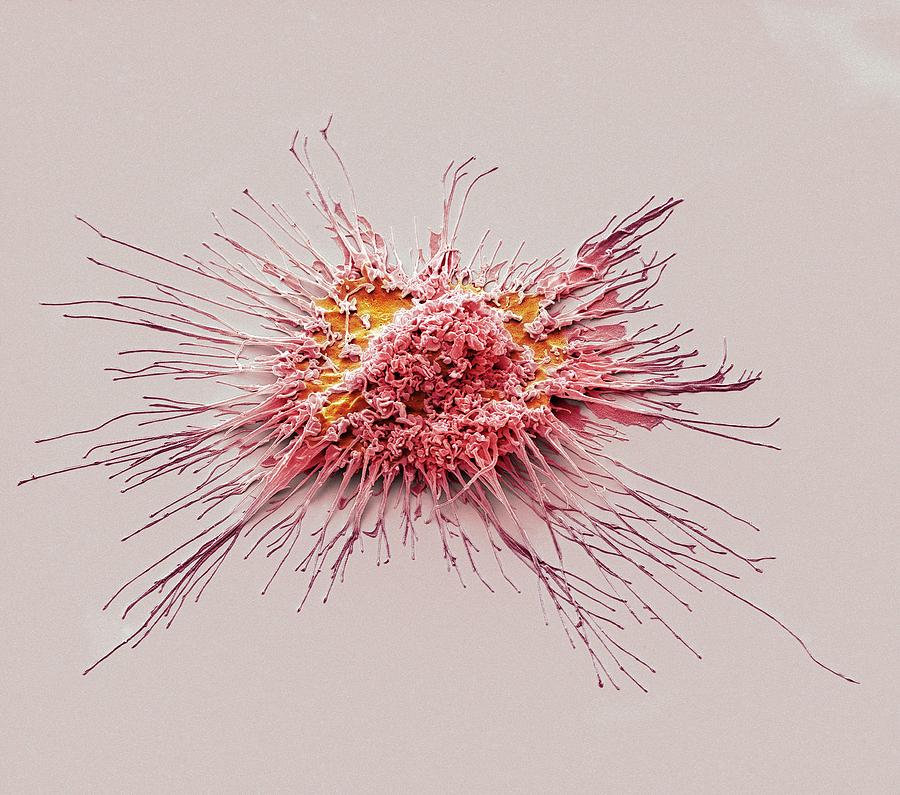 Dendritic Cell Photograph by Steve Gschmeissner/science Photo Library