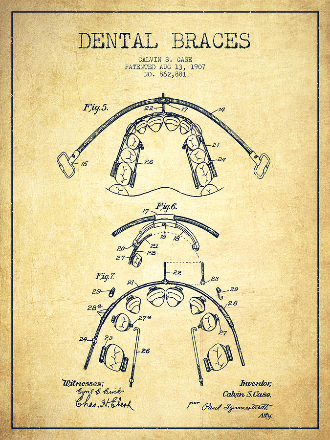 Vintage Digital Art - Dental braces Patent From 1907 - Vintage by Aged Pixel