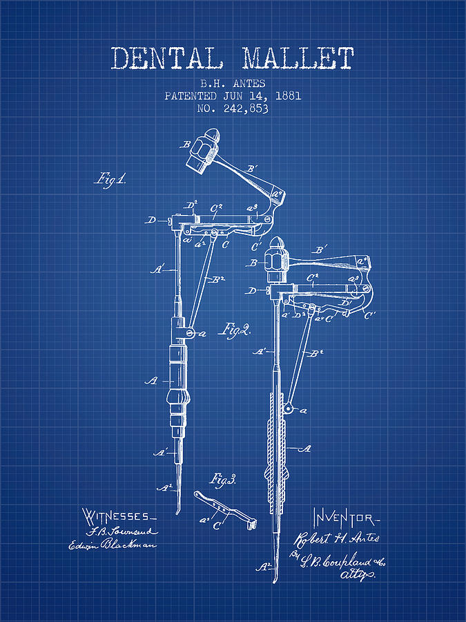 Pliers Digital Art - Dental Mallet patent from 1881 - Blueprint by Aged Pixel