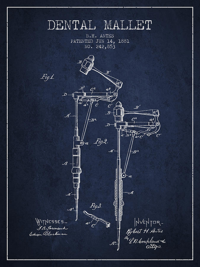 Pliers Digital Art - Dental Mallet patent from 1881 - Navy Blue by Aged Pixel