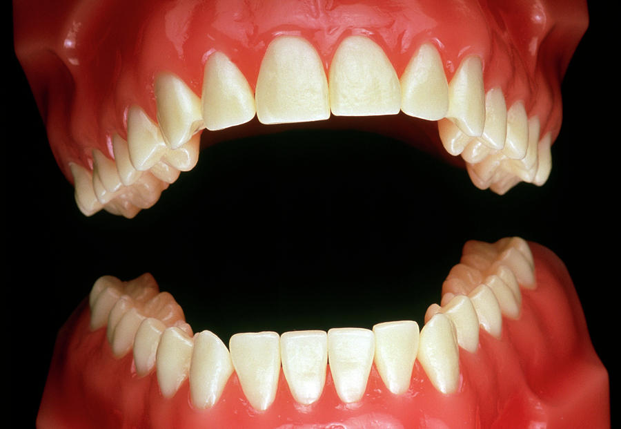 False Teeth