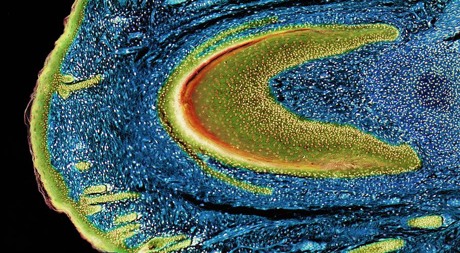 Nail Photograph - Developing Nail by Steve Gschmeissner/science Photo Library