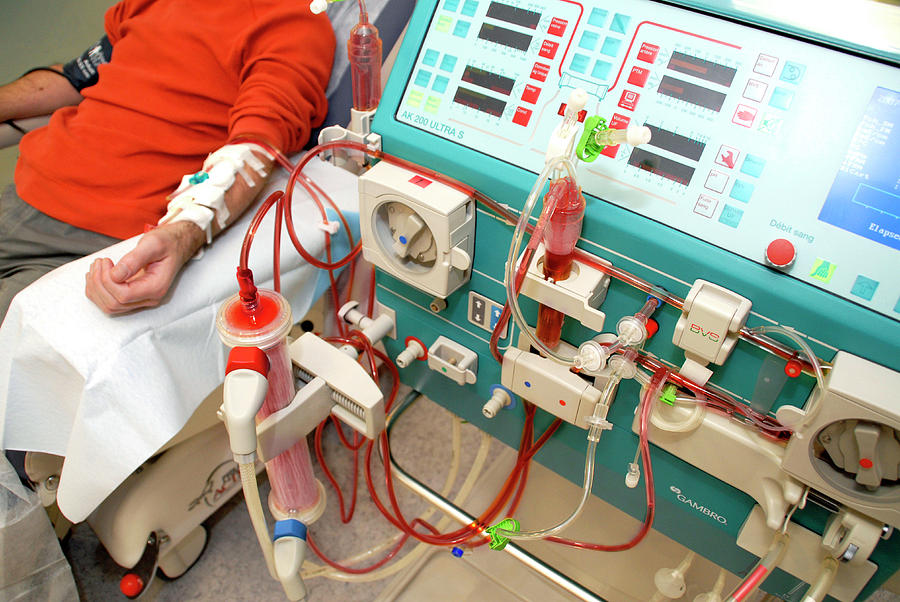 Dialysis Machine Photograph by Aj Photo/science Photo Library