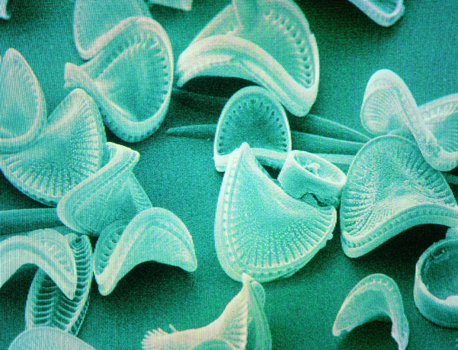 Diatom Algae Photograph by Power And Syred/science Photo Library
