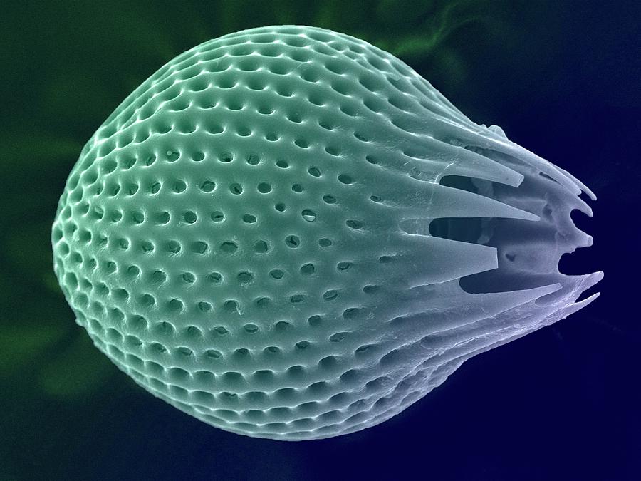 Diatom Photograph by Ami Images