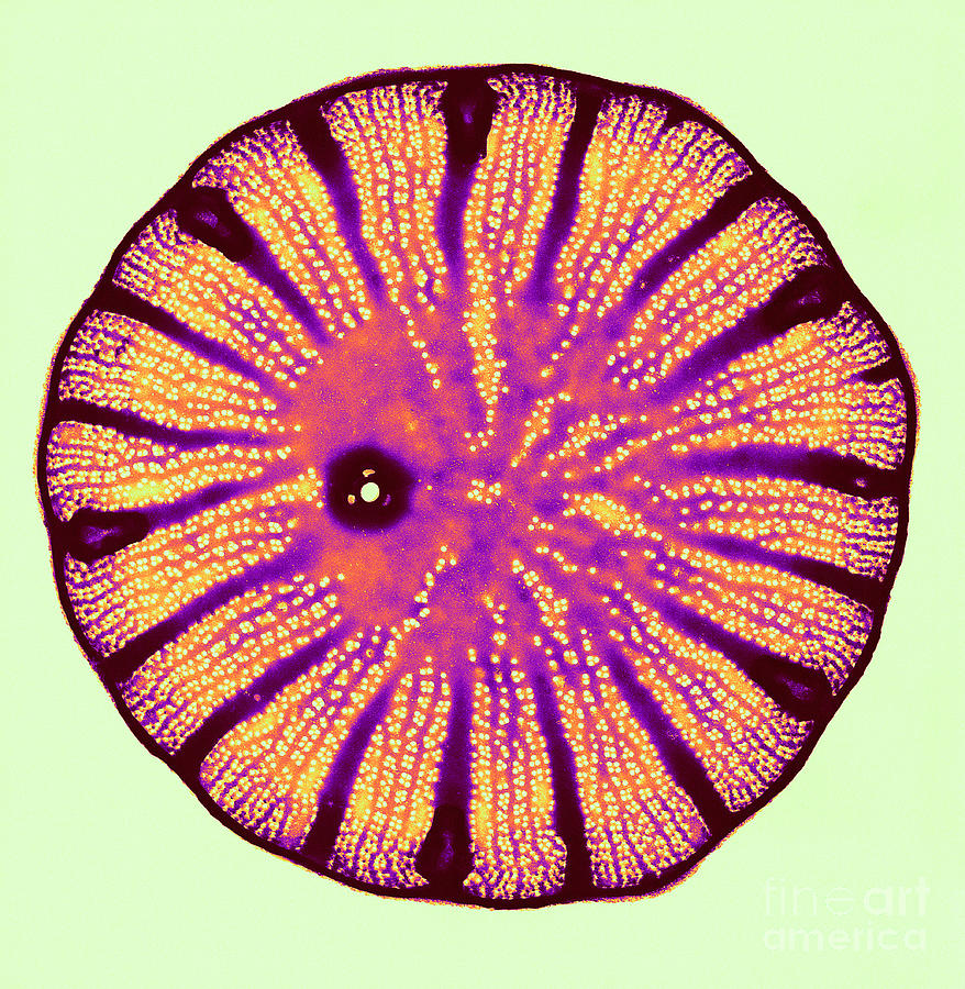 Diatom, Cyclotella Meneghiniana Photograph by Biophoto Associates