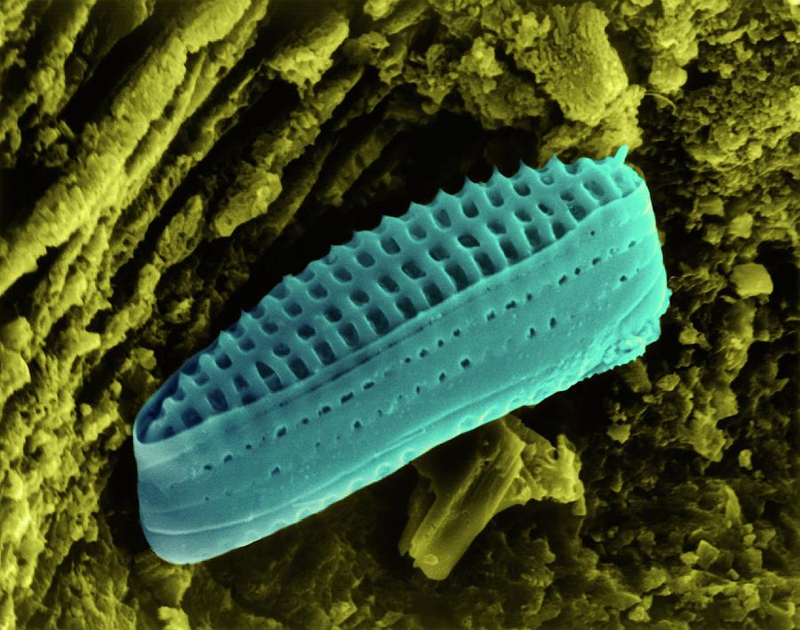 Diatom Frustule (pennate) Photograph by Dennis Kunkel Microscopy/science Photo Library
