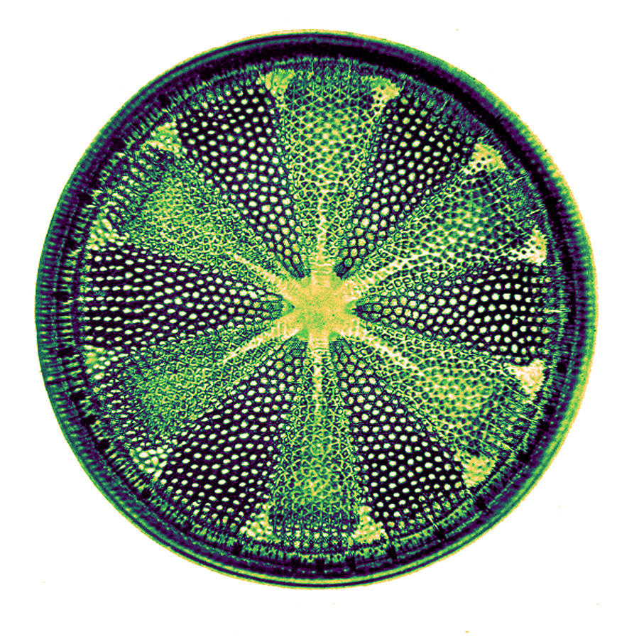 Diatom, Heliopelta Metil, Early Photograph by Science Source