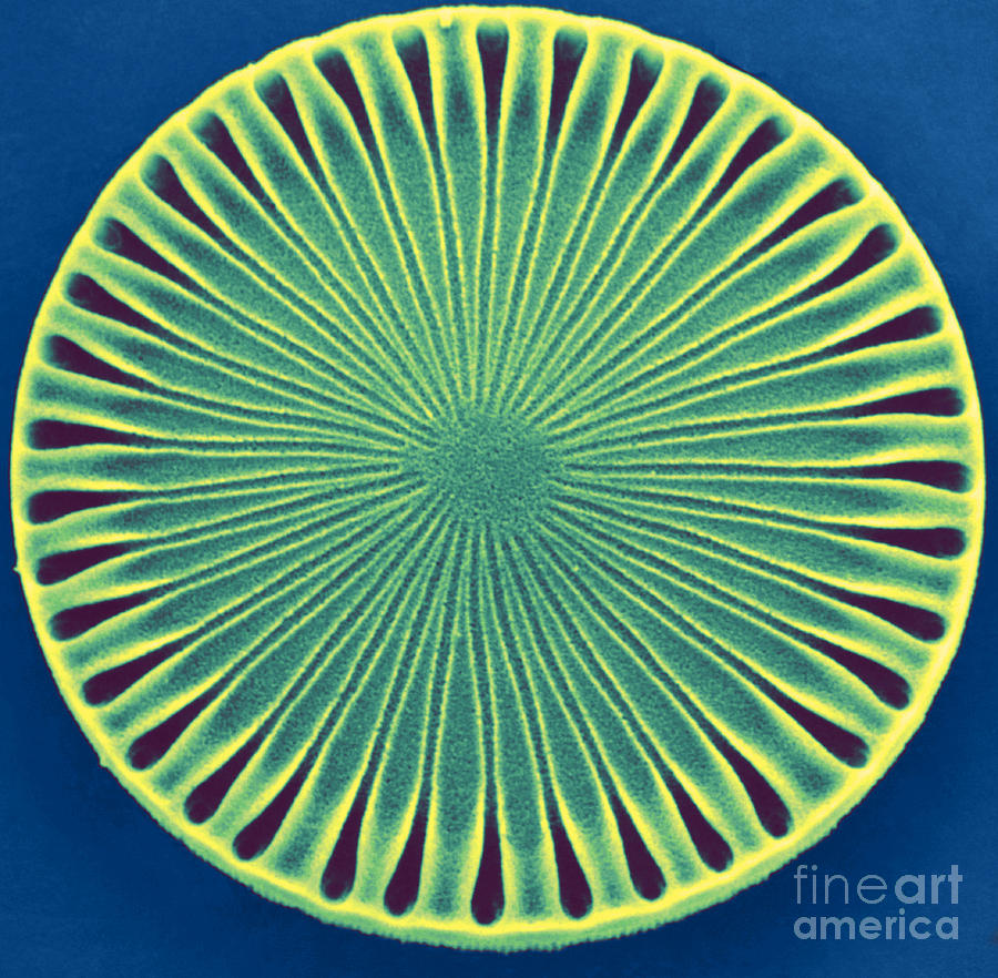 Diatom - Paralia Sol Photograph by Biophoto Associates
