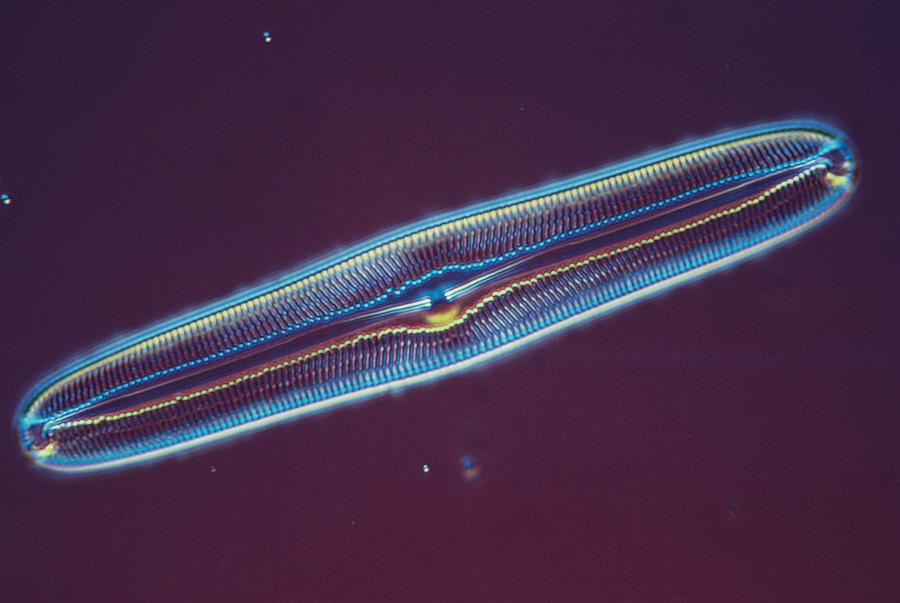 Diatom - Pinnularia Major Photograph by Perennou Nuridsany