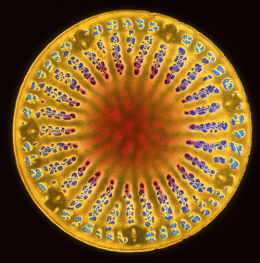 Diatom Photograph by Professor Anne Smith/science Photo Library
