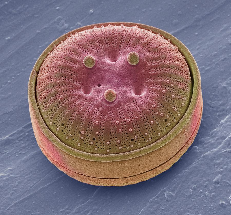 Diatom Photograph by Steve Gschmeissner