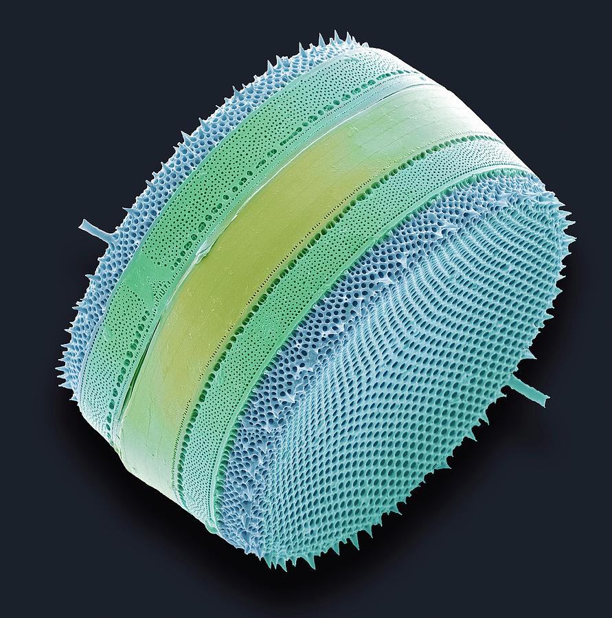 Diatom Photograph by Steve Gschmeissner/science Photo Library
