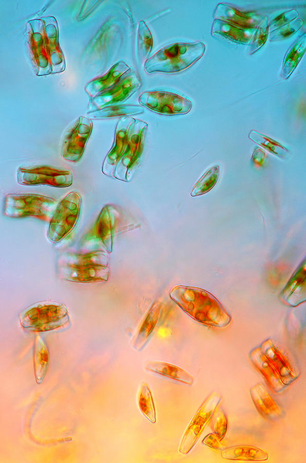 Diatoms, Lm Photograph by Marek Mis