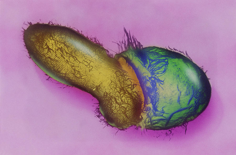 Protozoa Photograph - Didinium 2 Of 4, Sem by Greg Antipa